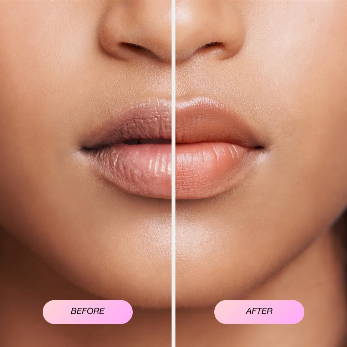 Collagen Lip Masks